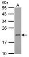 Mitochondrial Ribosomal Protein L21 antibody, GTX122070, GeneTex, Western Blot image 