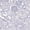 NaPi-2b antibody, HPA037989, Atlas Antibodies, Immunohistochemistry paraffin image 