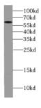 Cytochrome P450 Family 4 Subfamily F Member 11 antibody, FNab02171, FineTest, Western Blot image 