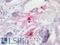 Chymase 1 antibody, LS-B4134, Lifespan Biosciences, Immunohistochemistry paraffin image 