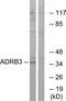 Adrenoceptor Beta 3 antibody, TA313387, Origene, Western Blot image 