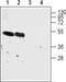 Cholinergic Receptor Nicotinic Alpha 7 Subunit antibody, PA5-77505, Invitrogen Antibodies, Western Blot image 