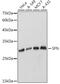 Stratifin antibody, GTX32418, GeneTex, Western Blot image 