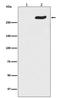 RNA Polymerase II Subunit A antibody, P01029-2, Boster Biological Technology, Western Blot image 