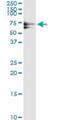 Polo Like Kinase 1 antibody, H00005347-M01, Novus Biologicals, Immunoprecipitation image 