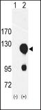 Receptor Tyrosine Kinase Like Orphan Receptor 2 antibody, PA5-14727, Invitrogen Antibodies, Western Blot image 