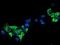 Sirtuin 5 antibody, NBP2-01003, Novus Biologicals, Immunocytochemistry image 