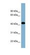 Inositol-Tetrakisphosphate 1-Kinase antibody, NBP1-55389, Novus Biologicals, Western Blot image 