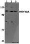 Pre-MRNA Processing Factor 40 Homolog A antibody, A06792, Boster Biological Technology, Western Blot image 