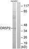 Olfactory Receptor Family 5 Subfamily P Member 2 antibody, PA5-39657, Invitrogen Antibodies, Western Blot image 