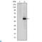 Cyclin Dependent Kinase 9 antibody, LS-C812544, Lifespan Biosciences, Western Blot image 