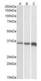 Troponin T3, Fast Skeletal Type antibody, orb106868, Biorbyt, Western Blot image 
