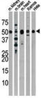 Parkin RBR E3 Ubiquitin Protein Ligase antibody, abx025068, Abbexa, Western Blot image 