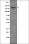 ALK Receptor Tyrosine Kinase antibody, orb336119, Biorbyt, Western Blot image 