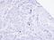 Transient Receptor Potential Cation Channel Subfamily M Member 2 antibody, NBP1-33416, Novus Biologicals, Immunohistochemistry frozen image 
