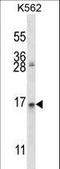 Anterior Gradient 2, Protein Disulphide Isomerase Family Member antibody, LS-C156158, Lifespan Biosciences, Western Blot image 