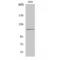 Mitogen-Activated Protein Kinase Kinase Kinase 21 antibody, LS-C384569, Lifespan Biosciences, Western Blot image 