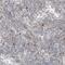 Poly(ADP-Ribose) Polymerase Family Member 10 antibody, NBP1-83689, Novus Biologicals, Immunohistochemistry frozen image 