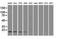 Superoxide Dismutase 1 antibody, NBP1-47993, Novus Biologicals, Western Blot image 