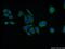 VPS26, Retromer Complex Component A antibody, 12804-1-AP, Proteintech Group, Immunofluorescence image 