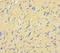 Intestine Specific Homeobox antibody, A50318-100, Epigentek, Immunohistochemistry paraffin image 