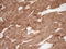 Secreted Frizzled Related Protein 2 antibody, LS-C791273, Lifespan Biosciences, Immunohistochemistry paraffin image 