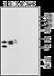 P2Y purinoceptor 14 antibody, GTX16887, GeneTex, Western Blot image 