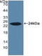 Cytochrome P450 Family 19 Subfamily A Member 1 antibody, LS-C292941, Lifespan Biosciences, Western Blot image 