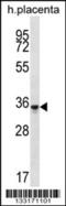 Olfactory Receptor Family 6 Subfamily K Member 6 antibody, 56-959, ProSci, Western Blot image 