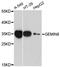 Gem Nuclear Organelle Associated Protein 8 antibody, A11881, Boster Biological Technology, Western Blot image 