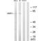 Zinc Finger Protein 875 antibody, A11100, Boster Biological Technology, Western Blot image 