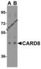 Caspase Recruitment Domain Family Member 8 antibody, 3187, ProSci, Western Blot image 