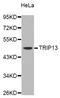 Thyroid Hormone Receptor Interactor 13 antibody, STJ26240, St John