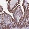 NADH:Ubiquinone Oxidoreductase Subunit A5 antibody, PA5-60270, Invitrogen Antibodies, Immunohistochemistry paraffin image 