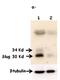 Snail Family Transcriptional Repressor 2 antibody, ab51772, Abcam, Western Blot image 