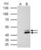 SET Nuclear Proto-Oncogene antibody, GTX113834, GeneTex, Immunoprecipitation image 