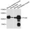 Glycogen Phosphorylase, Muscle Associated antibody, A9392, ABclonal Technology, Western Blot image 