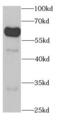 Karyopherin Subunit Alpha 1 antibody, FNab04634, FineTest, Western Blot image 
