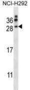 Neurturin antibody, abx027770, Abbexa, Western Blot image 