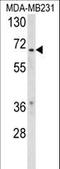Retinoid X Receptor Beta antibody, LS-C162821, Lifespan Biosciences, Western Blot image 