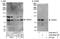 Tudor Domain Containing 3 antibody, A302-692A, Bethyl Labs, Immunoprecipitation image 