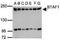 B-TFIID TATA-Box Binding Protein Associated Factor 1 antibody, NBP1-30911, Novus Biologicals, Western Blot image 