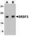 Serine And Arginine Rich Splicing Factor 3 antibody, A03127, Boster Biological Technology, Western Blot image 