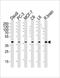 Eukaryotic Translation Initiation Factor 4E Family Member 3 antibody, orb304747, Biorbyt, Western Blot image 