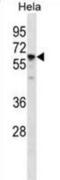 Chaperonin Containing TCP1 Subunit 7 antibody, abx031485, Abbexa, Western Blot image 