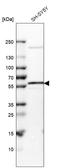 Membrane Palmitoylated Protein 6 antibody, HPA019085, Atlas Antibodies, Western Blot image 