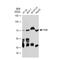 Eukaryotic Translation Initiation Factor 2 Alpha Kinase 2 antibody, GTX00929, GeneTex, Western Blot image 