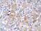 LIM Homeobox 1 antibody, A05816, Boster Biological Technology, Immunohistochemistry paraffin image 