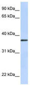 Transmembrane Protein 200B antibody, TA335304, Origene, Western Blot image 