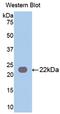 Leucine Rich Repeat Kinase 2 antibody, abx103032, Abbexa, Western Blot image 